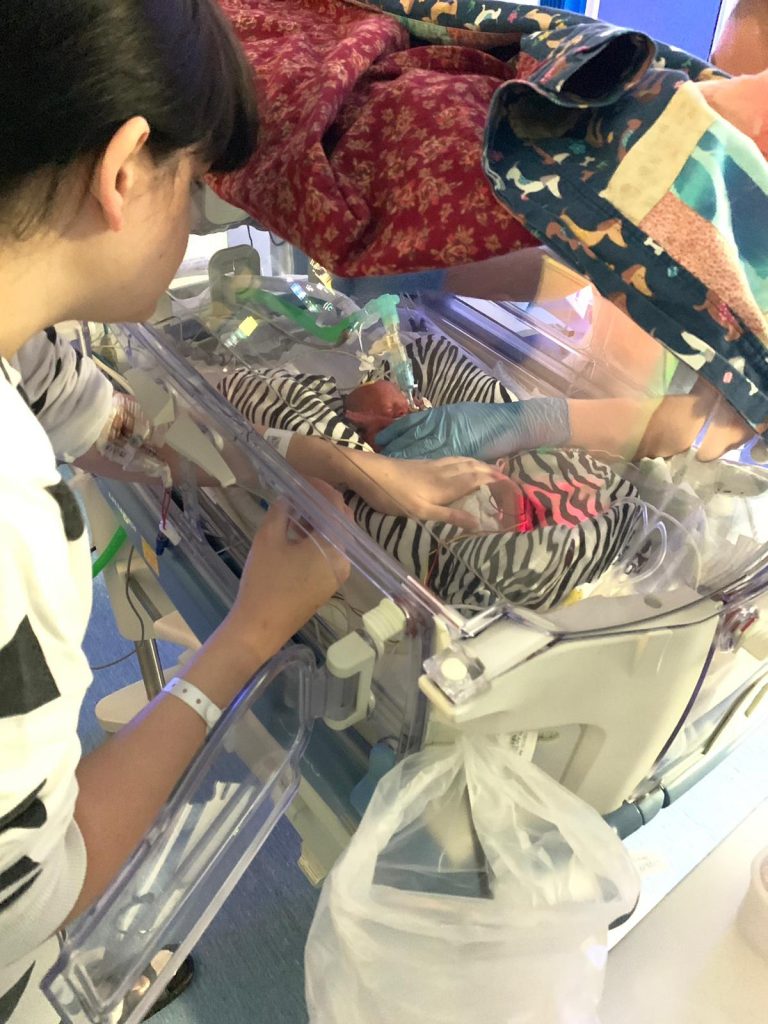 What it&rsquo;s like to live with PTSD after my baby was born at 28 weeks.